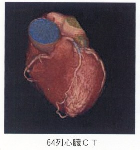 64列心臓CT
